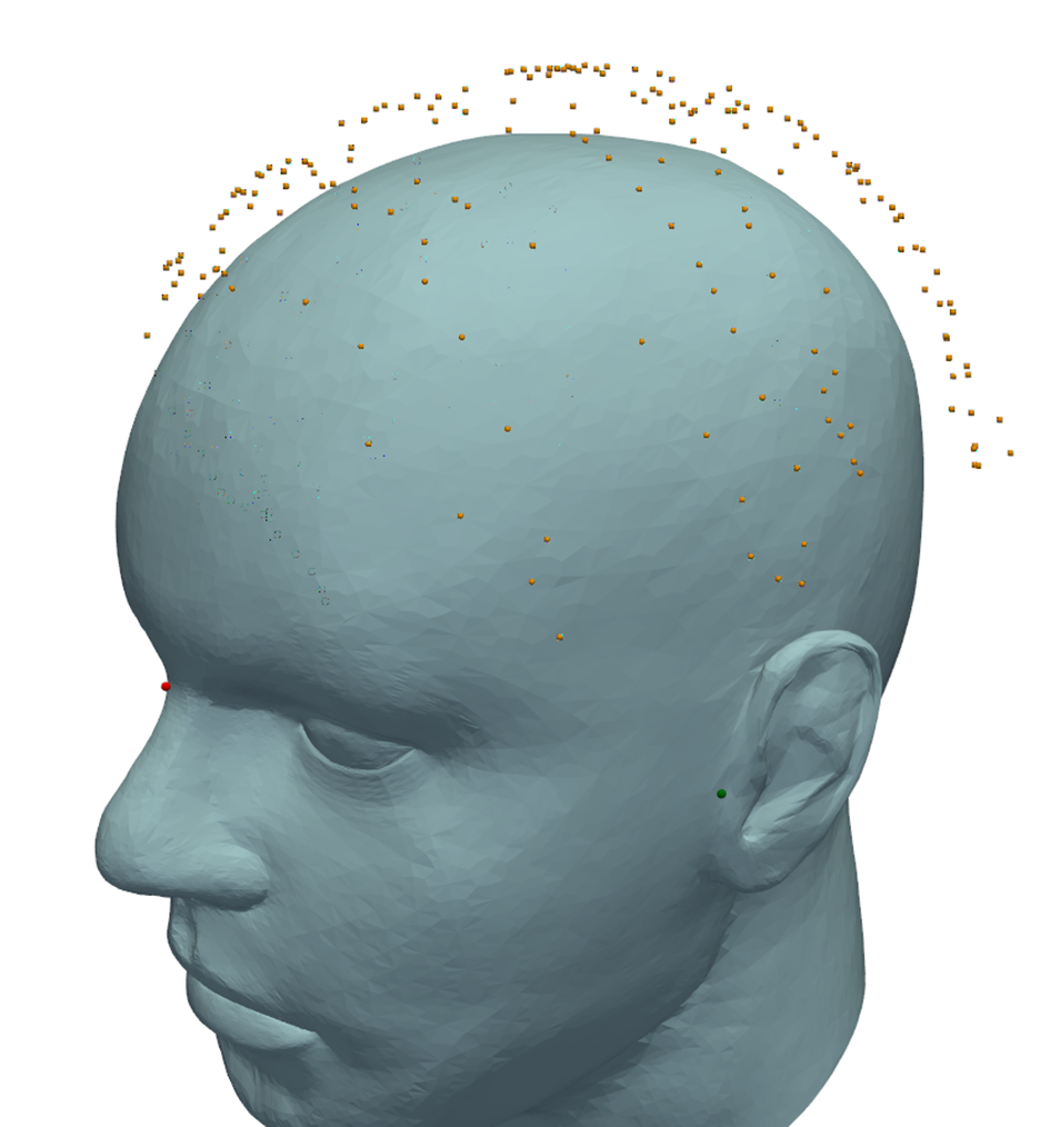Aligned head model and measured scalp points
